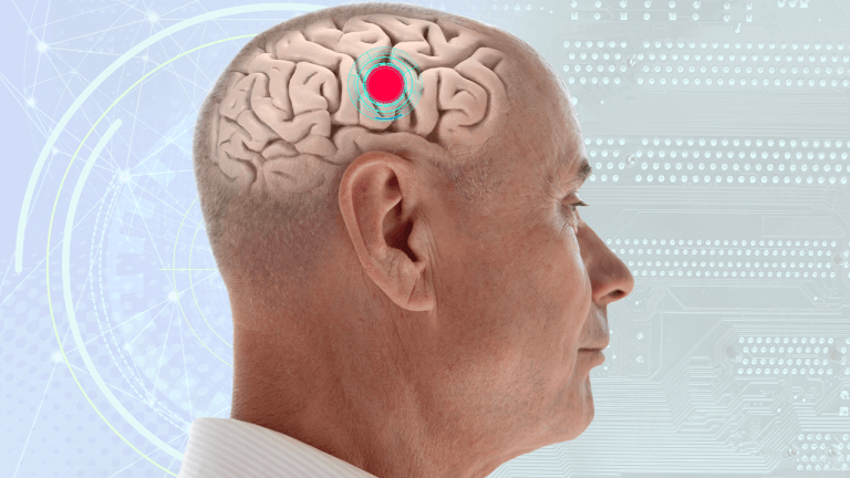 200,000 Human Neurons Learned to Play Doom, Pointing to Low-Power Biological Computing
